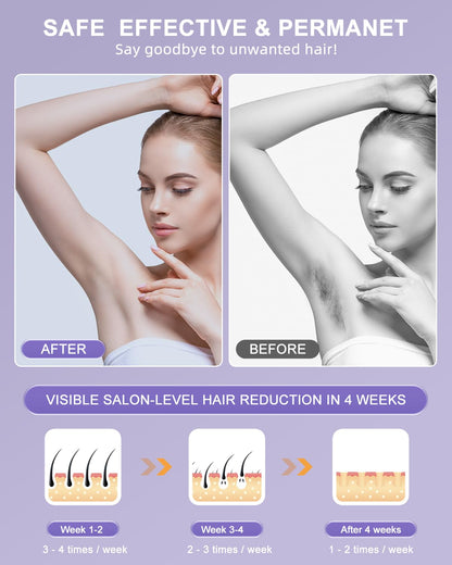 Prestique™- IPL Hair Removal Handset